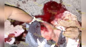 Le destrozan la cabeza y muere en el Hospital Civil de Naranjos Le destrozan la cabeza y muere en el Hospital Civil de Naranjos