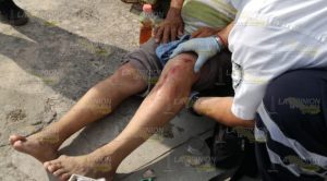 Embestido por un auto