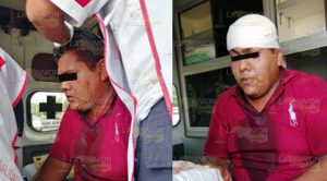 Comerciante golpeado en los campos del cuatro y medio