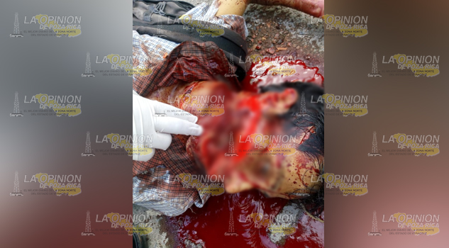 Jardinero degollado, fue herido con un machete en al menos cuatro ocasiones
