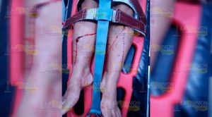 Violento atraco en Papantla deja 2 personas lesionadas