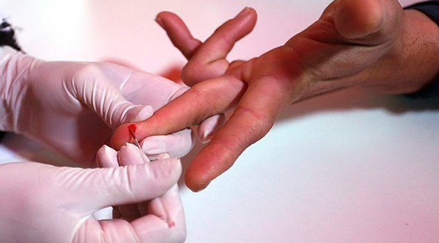 Sorprende el aumento de casos de hepatitis y VIH en adultos mayores