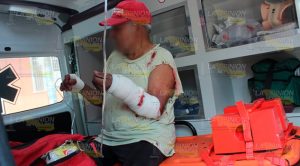 Anciano se macheteo cuando chapeaba su terreno en Coatzintla