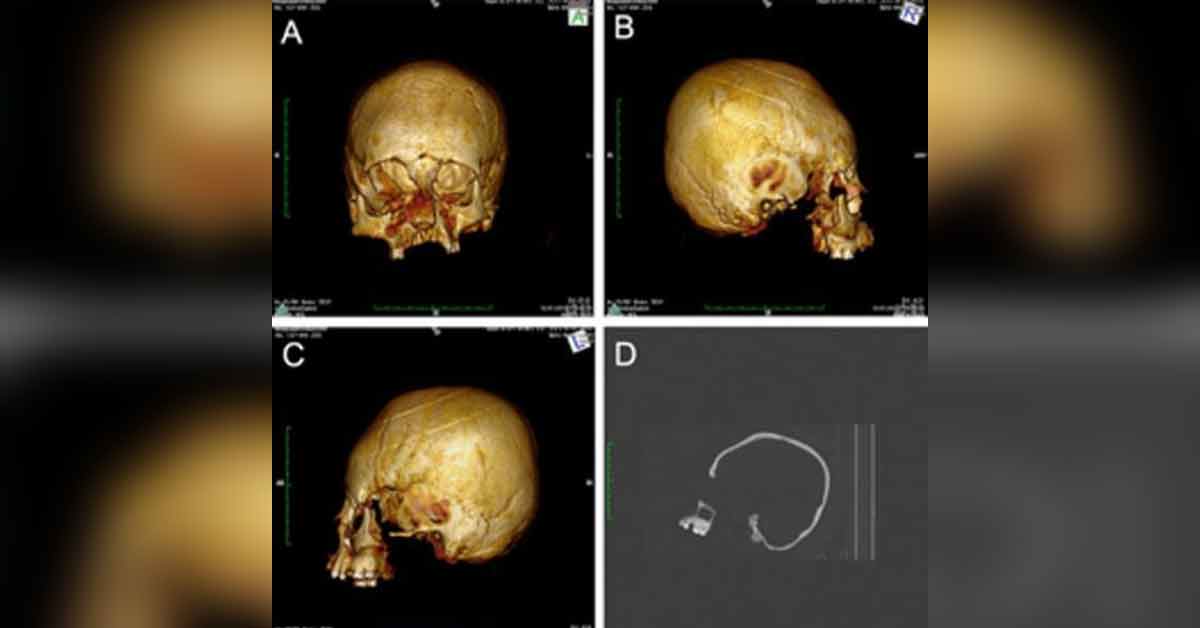 Antiguas Cabezas Alienígenas Descubiertas en Croacia