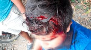 Sábado de accidentes en inmediaciones de Álamo; 3 lesionados