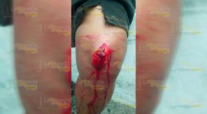 Herido a machetazos por riña en Papantla Lo agarran a machetazos por riña en Papantla