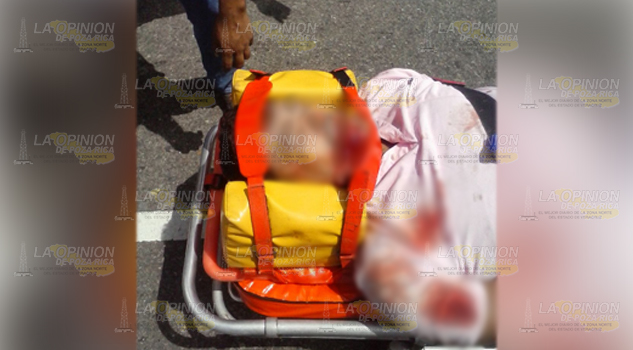 Se arman de valor y golpean a “la pulga” en San Felipe Orizatlán
