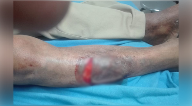 En Tuxpan, sufre una caída y se lesiona