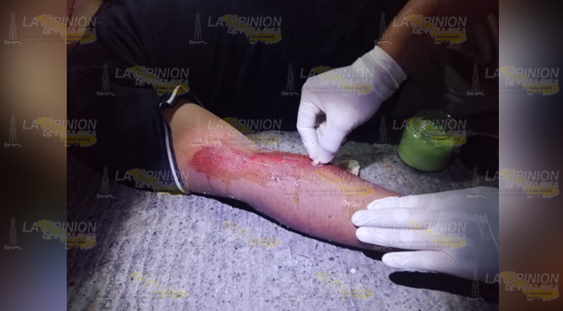 Joven voló tras chocar contra el camellón en la División de Oriente; se abrió el rostro