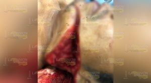 Le desfiguran el rostro a campesino de Atzalan