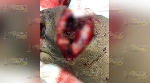 Le desfiguran el rostro a campesino de Atzalan