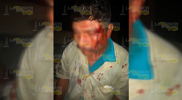 Lesionan a jornalero y le roban 5 mil pesos cerca de la comunidad El Arenal Lesionan a jornalero y le roban 5 mil pesos cerca de la comunidad El Arenal