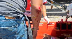 Pareja en motocicleta se lesionan tras derrapar en la comunidad de Plan de Ayala de Tihuatlán Pareja en motocicleta se lesionan tras derrapar en Tihuatlán