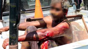 Macheteado en Tuxpan vive de milagro Riñen a machetazos por un termo con hielo en colonia de Tuxpan