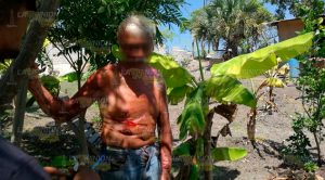 Macheteado en Tuxpan vive de milagro