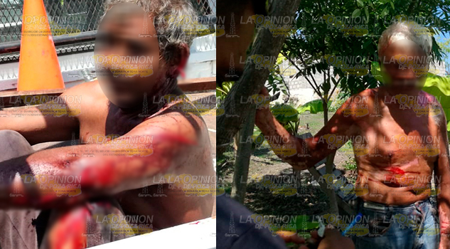 Riñen a machetazos por un termo con hielo en colonia de Tuxpan Riñen a machetazos por un termo con hielo en colonia de Tuxpan