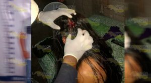 Violento marido le abre la cabeza a su esposa en Espinal, Veracruz Violento marido le abre la cabeza a su esposa en Espinal, Veracruz