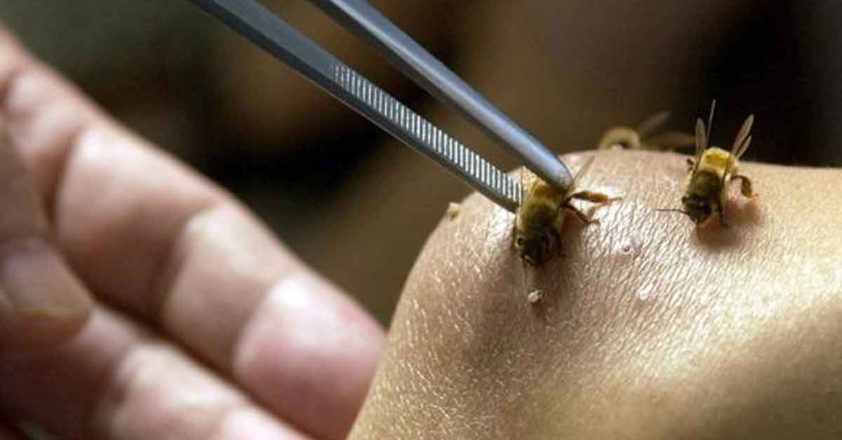 Apiterapia, otra alternativa contra algunas enfermedades