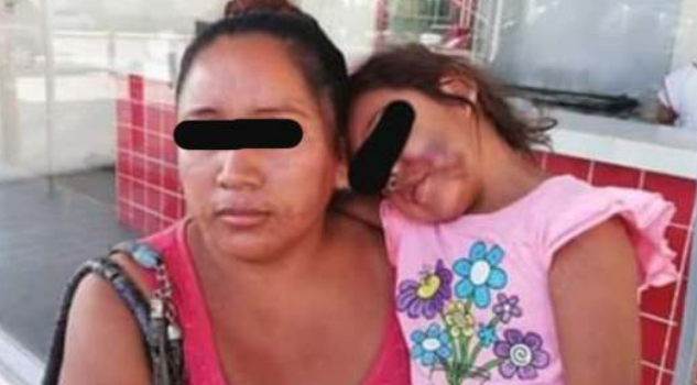 ¡Terminó en el hospital! Niña de 3 años recibe “golpiza” en kinder y la mamá demanda a maestras