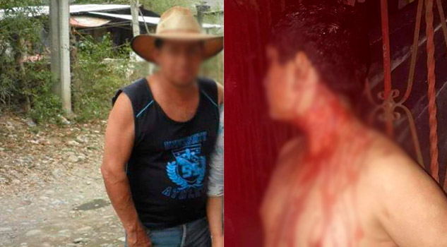 Violento sujeto agrede a botellazos a un menor en Entabladero, Espinal Violento sujeto agrede a menor en Entabladero, Espinal