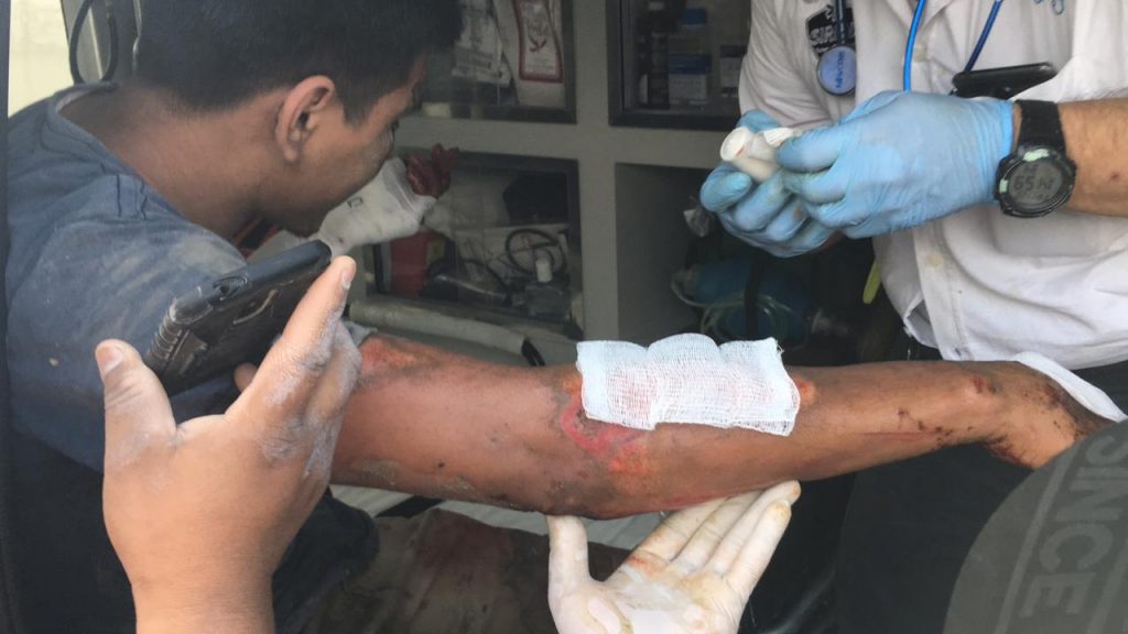 Derrapa motociclista en el cruce de la UV en Tuxpan