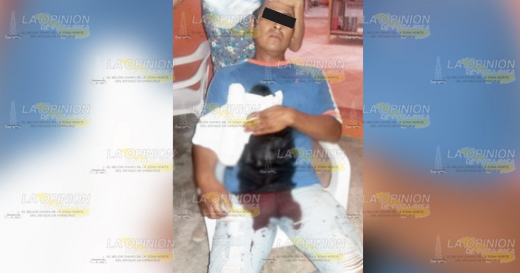 Por líos amorosos, le dispararon a quema ropa