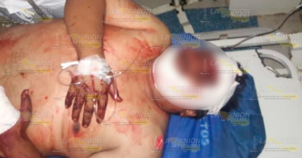 Lesionado al caer de una motocicleta
