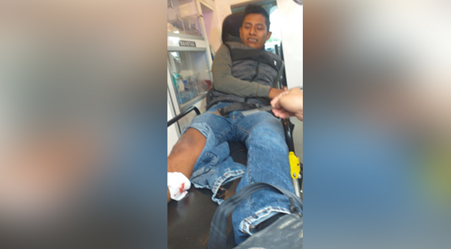 Motociclista, choca y se fractura una pierna