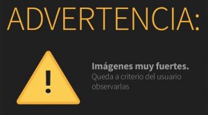 Fallido intento de suicidio