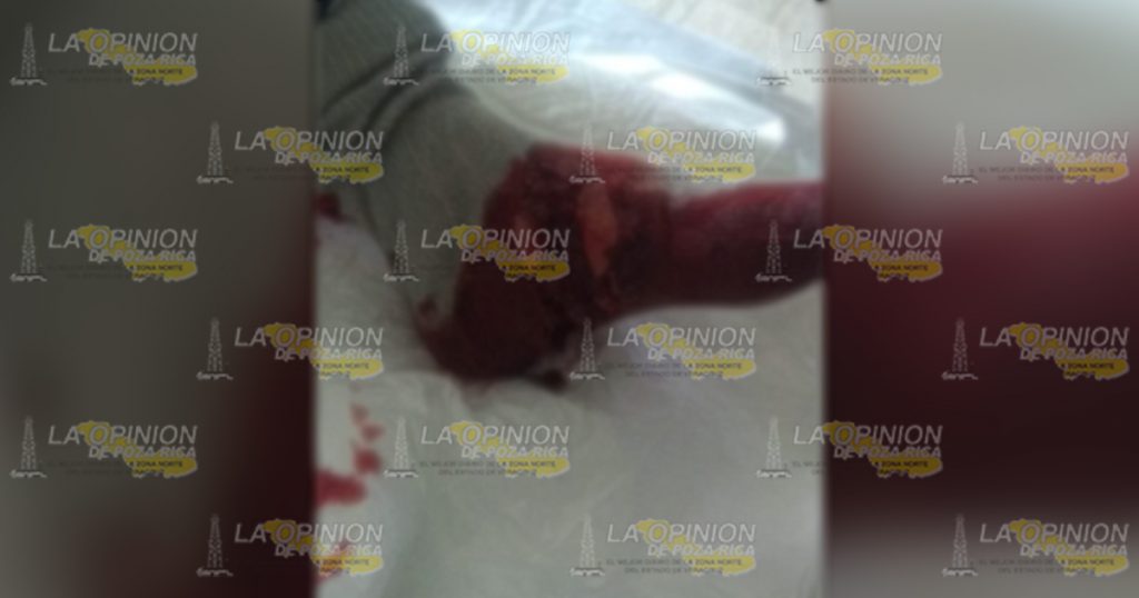 Patrullero se dispara con una escopeta