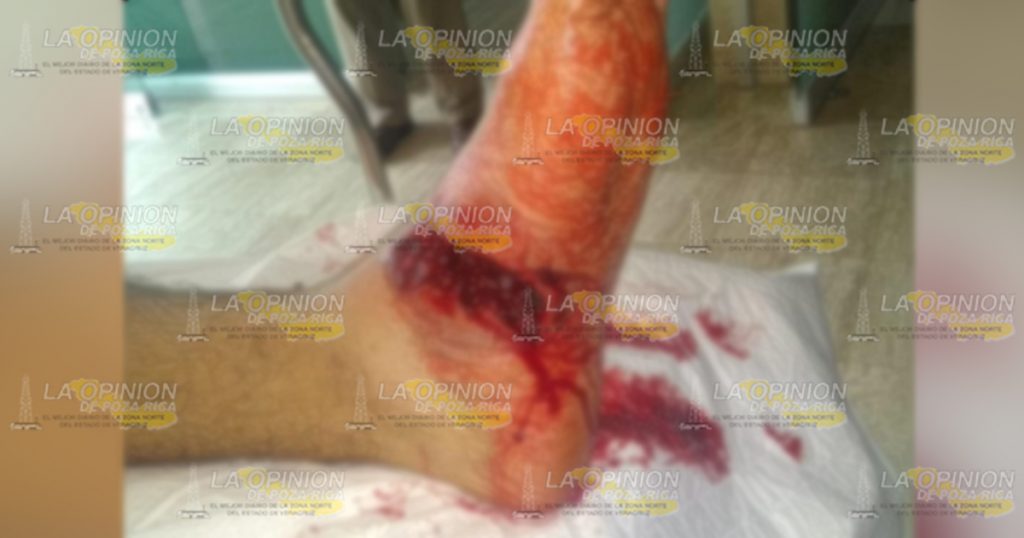 Patrullero se dispara con una escopeta