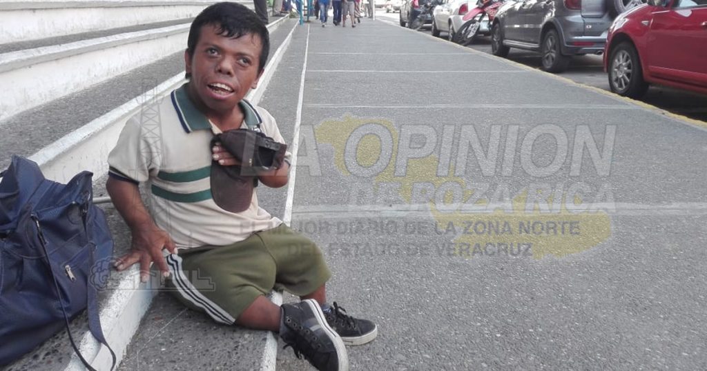 Claman ayuda para "niño" con acondroplasia