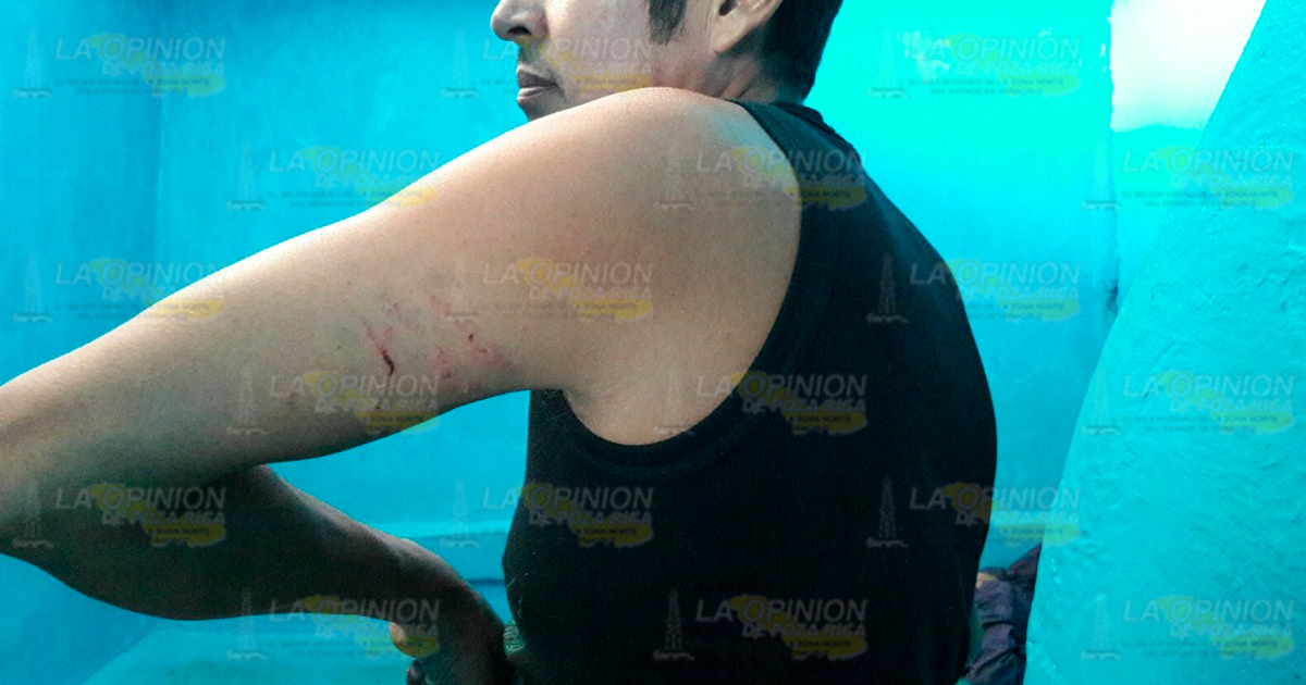 Sujeto que presuntamente se encontraba tomando en su cuarto fue atacado por su esposa