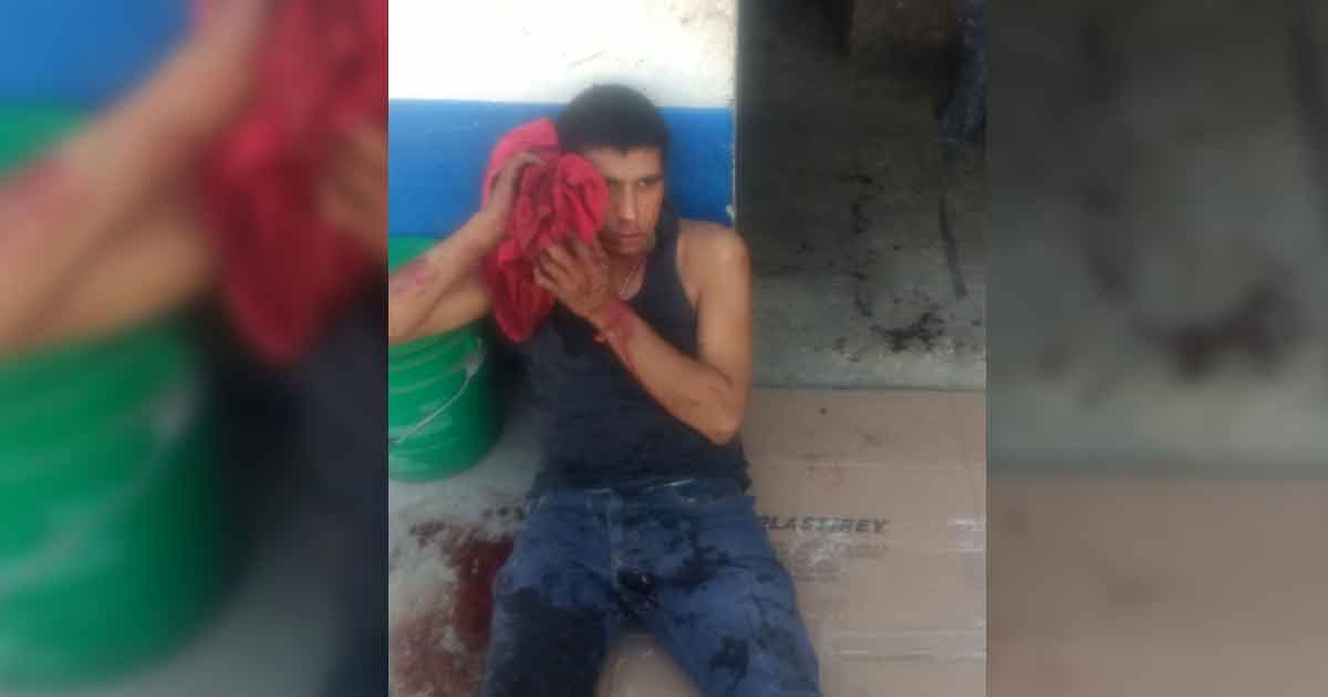 ¡Automóvil envía a ciclista al hospital!