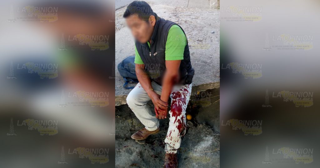 Taxista de Coxquihui arrolla a motociclista