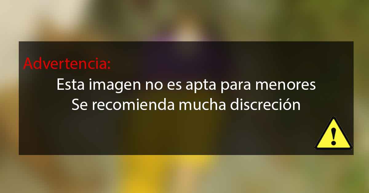 Mujer atacada por un perro callejero