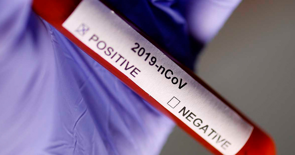 Cómo evitar el coronavirus, ¡aquí te decimos!