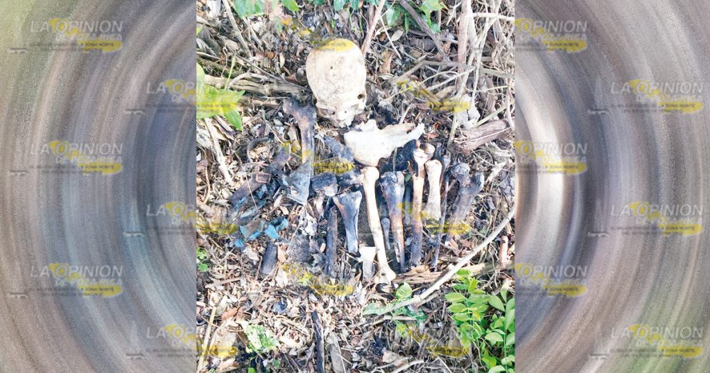 ¡Calcinaron hasta los huesos!