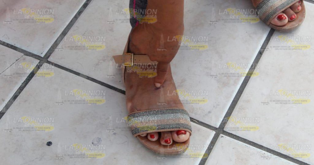 Habitantes son atacados por pitbull en la Allende