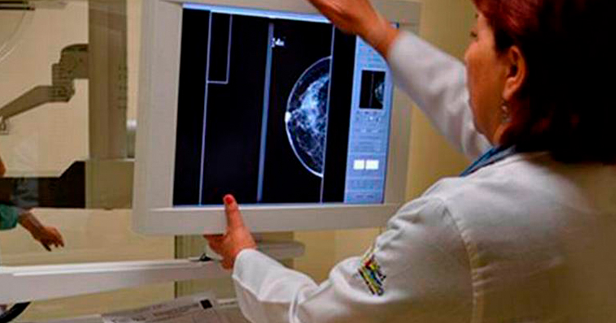 Proponen reconstrucción gratuita de mamas de mujeres con cáncer