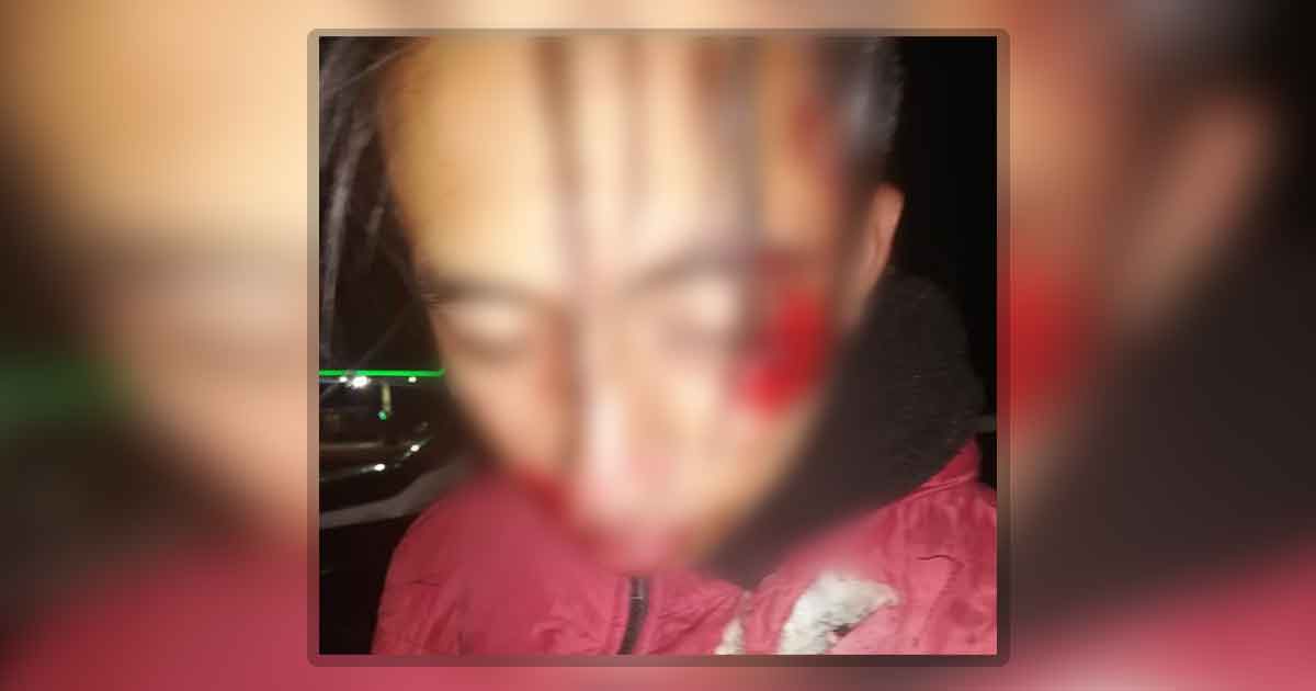 Motociclistas casi se matan en Tlapacoyan