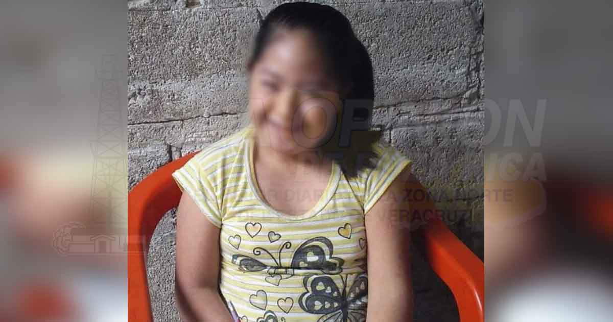 Piden apoyo para una niña con síndrome de down que se quedó huérfana