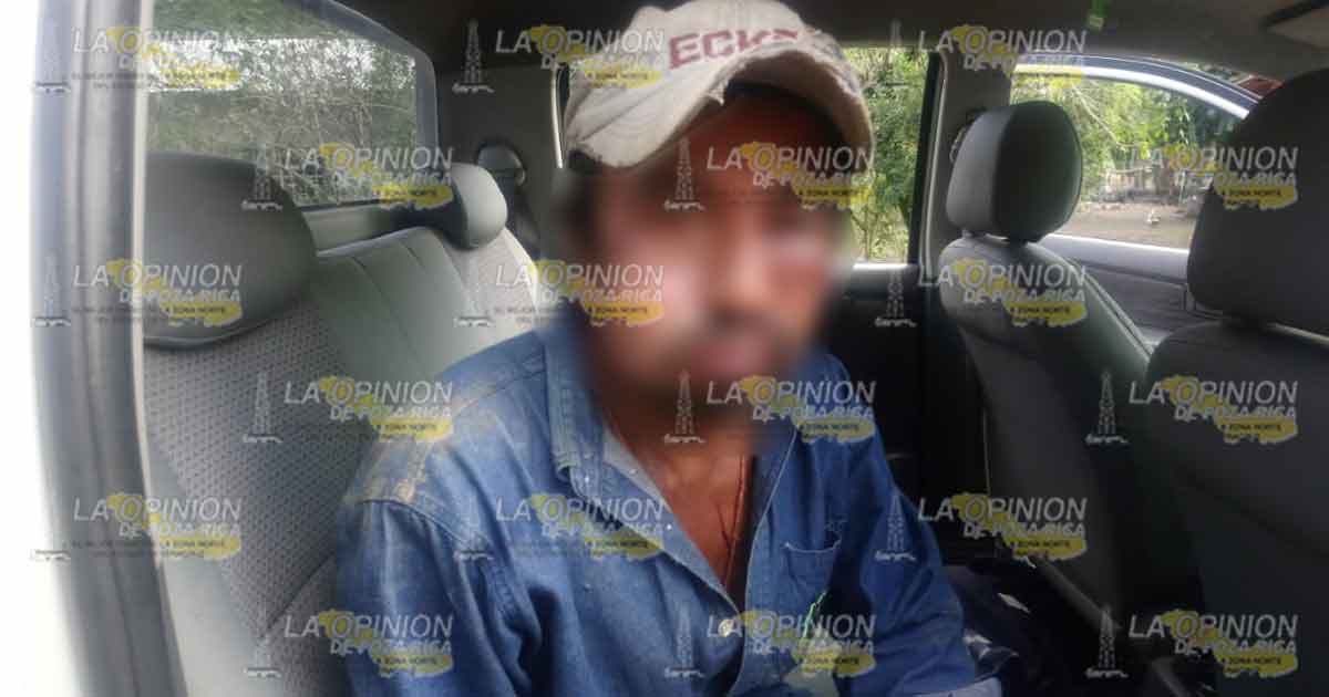 Sobrino desfigura el rostro de su tío a golpes