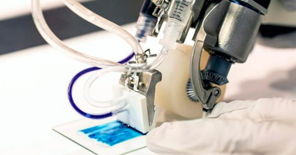 Crean impresora 3D de piel para tratar quemaduras graves