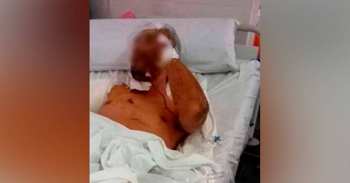 ¡Perro lo prende del brazo!