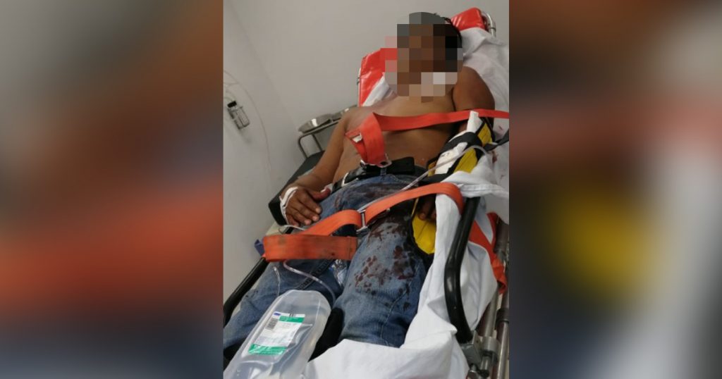 ¡Baleado con escopeta; está grave!