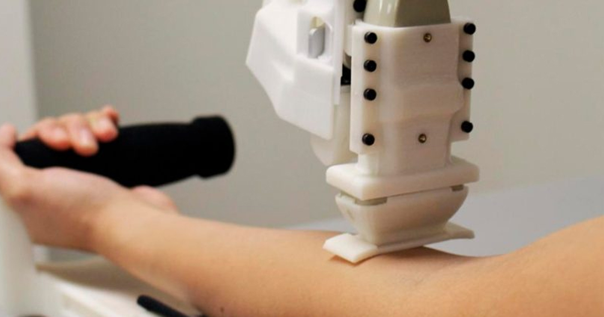 Diseñan un robot que saca sangre mejor que los médicos