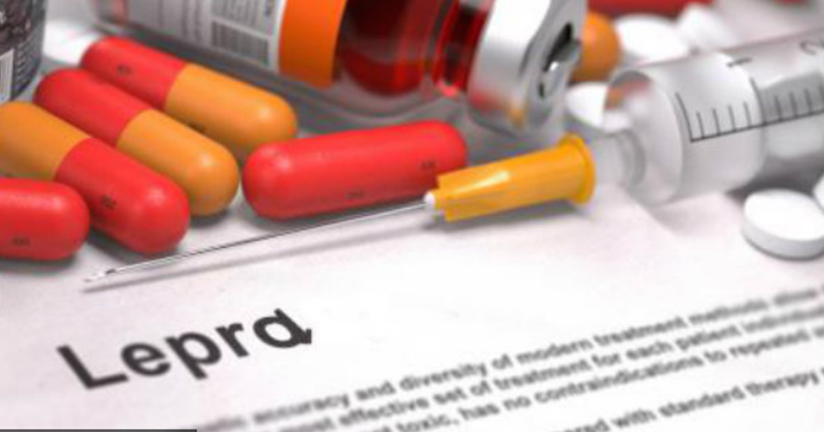 Detectan 5 casos de lepra en el Istmo de Tehuantepec