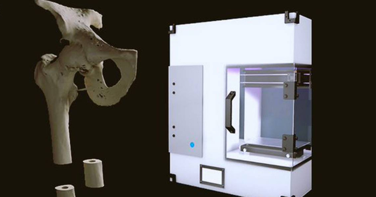 Estudiante mexicano es el primero en imprimir huesos biodegradables