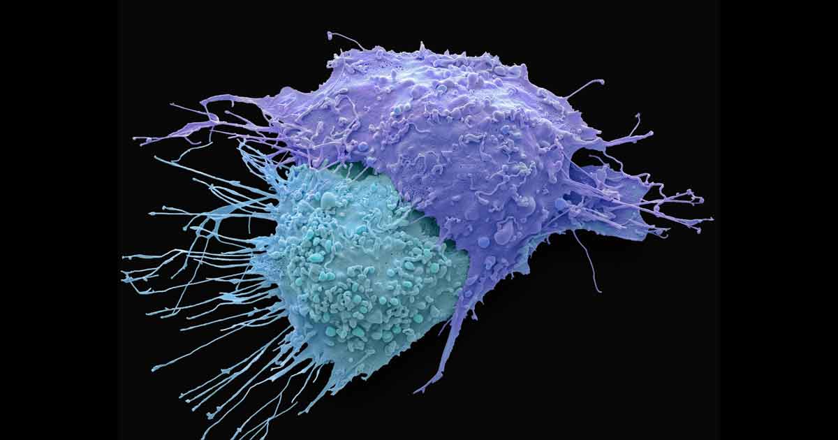 El mayor estudio genómico del cáncer abre la posibilidad de detectarlo antes de que aparezca